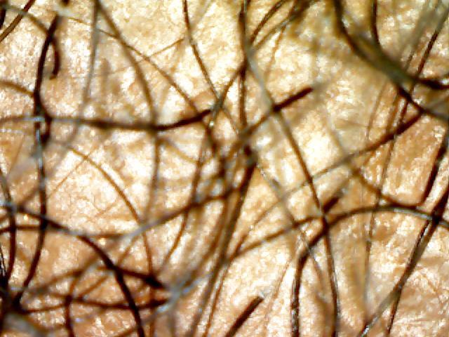 HAIR LOSS IS MORE THAN HAIR | Trichology Assessment* Workshop