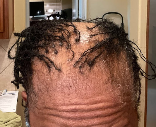 ROXXLOXX™ Prosthesis Class